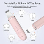 ✨🧖‍♀️ ANLAN Ultrasonic Skin Scrubber 💎 | Deep Cleaning Peeling Shovel Facial Cleaner 🫧 | Ultrasonic Face Lifting & Skin Care Device