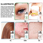 ✨💧 Korean Hyaluronic Acid Facial Serum (5ml) – Moisturizing & Rejuvenating Professional Skin Care Essence