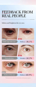 Instant Eye Bag Removal Cream Collagen Anti-Wrinkle Fade Fine Lines Firming Skin Anti Dark Circle Puffiness Brighten Eye Care