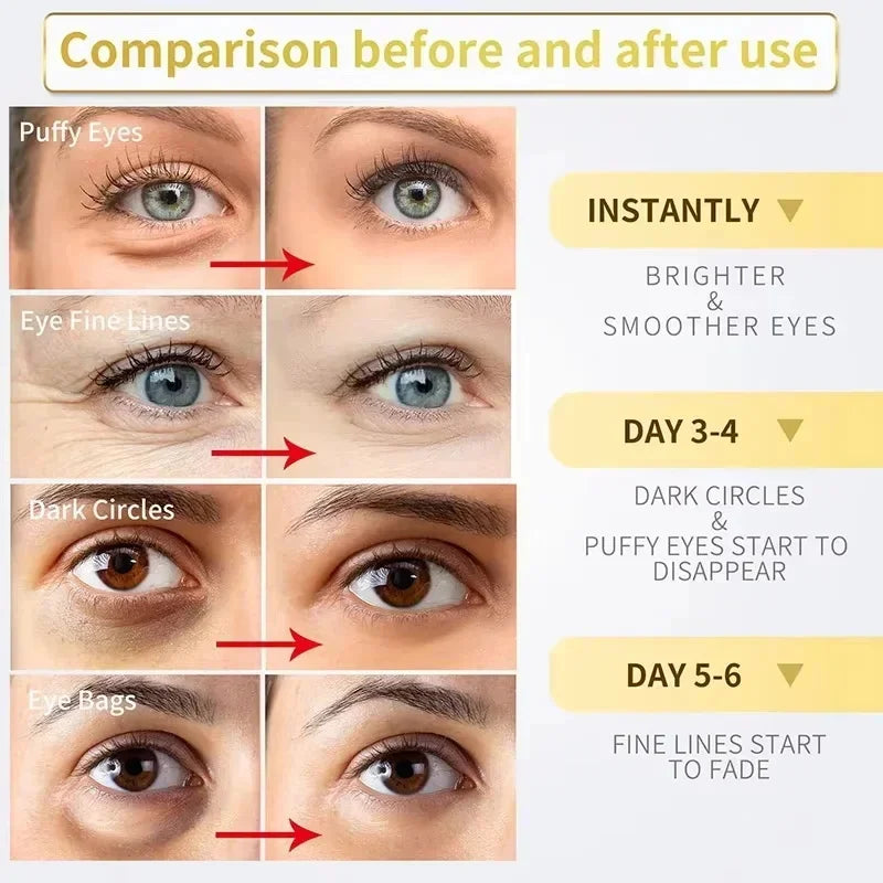 Instant Eye Bag Removal Cream Collagen Anti-Wrinkle Fade Fine Lines Firming Skin Anti Dark Circle Puffiness Brighten Eye Care