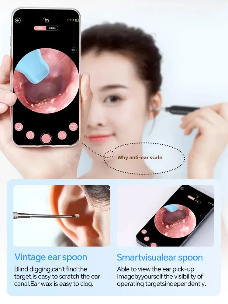 👂✨ Generation 2 Visual Ear Wax Cleaner Camera | Safe Earwax Removal Endoscope Tool 📷 | Smart Ear Cleaning Device – Black & White