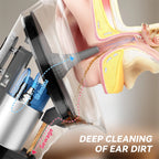 Upgraded Ear Wax Removal Kit with Temperature Sensor