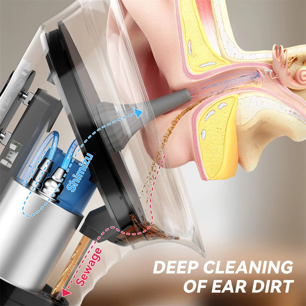 Upgraded Ear Wax Removal Kit with Temperature Sensor