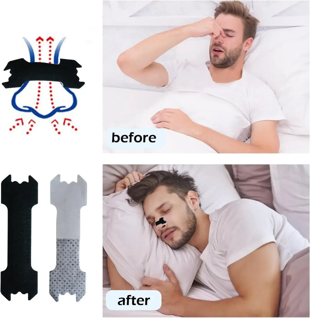 🌙😴 Extra-Strength Anti-Snoring Nose Patch Set – 30/90/150 Nasal Strips for Better Breathing & Easier Sleep