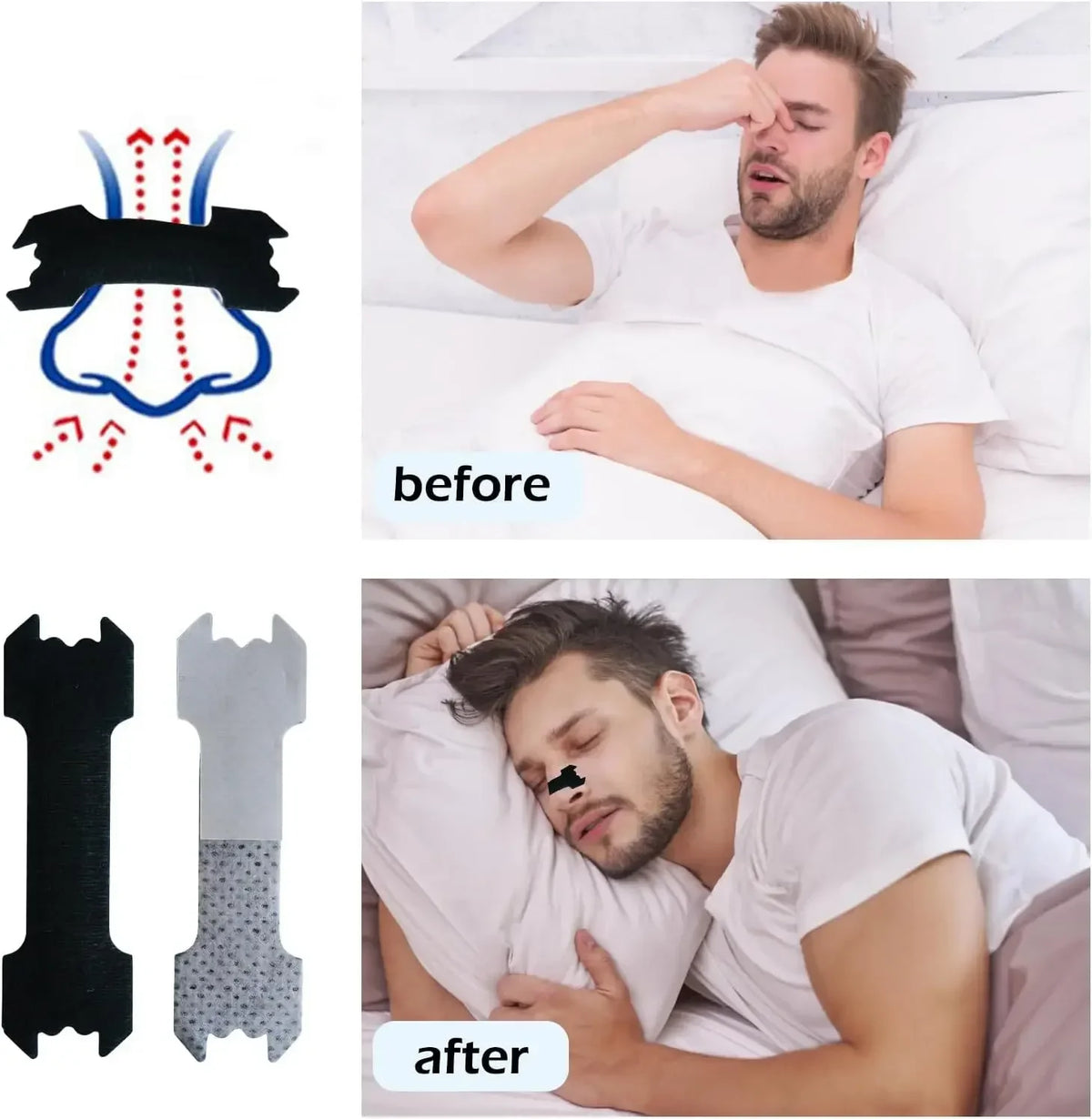 🌙😴 Extra-Strength Anti-Snoring Nose Patch Set – 30/90/150 Nasal Strips for Better Breathing & Easier Sleep