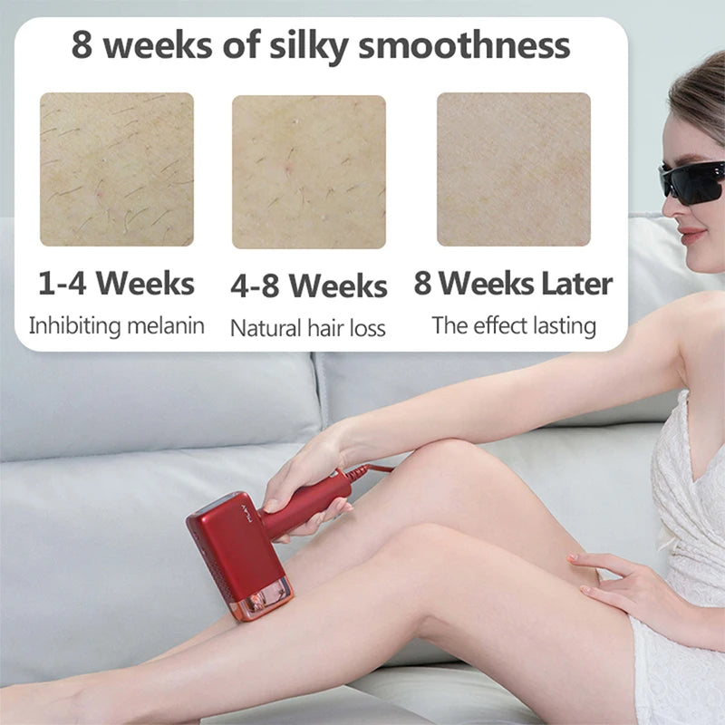 ✨ MLAY T14 IPL Hair Removal Device | ICE Cool Laser Epilator 3-in-1 ❄️ | 500,000 Flashes Permanent Hair Reduction for Body & Face