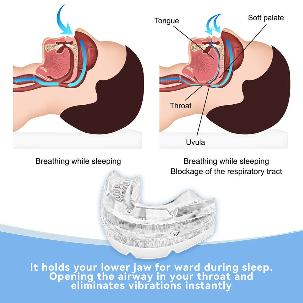 😴🌙 Adjustable Anti-Snoring Mouth Guard – Sleep Aid Mouthpiece for Snoring, Apnea Relief & Teeth Bruxism Protection