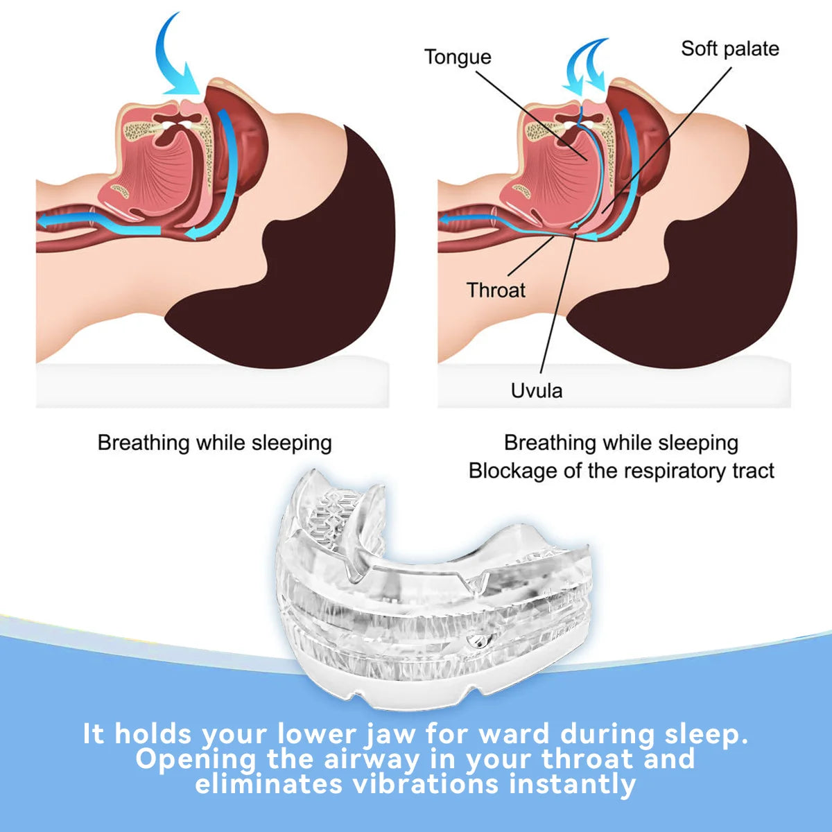 😴🌙 Adjustable Anti-Snoring Mouth Guard – Sleep Aid Mouthpiece for Snoring, Apnea Relief & Teeth Bruxism Protection