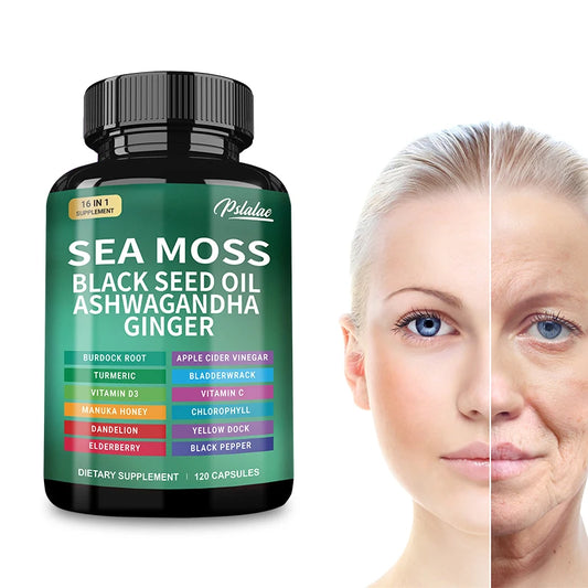 🌿 Sea Moss Supplement Capsules – Gut Health, Immunity Boost, Detox, Anti‑Aging, Antioxidant Support | Ashwagandha, Black Seed Oil, Ginger